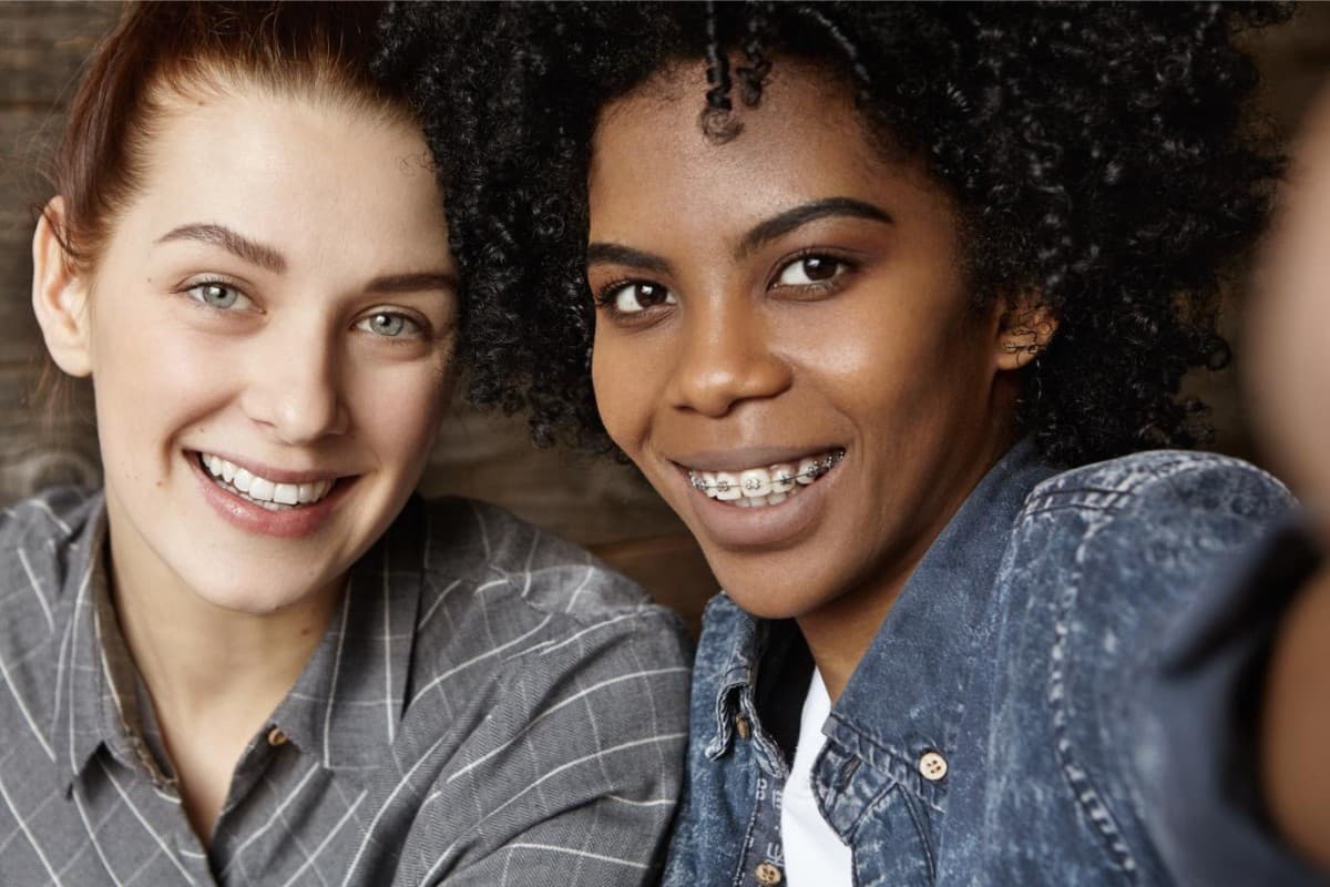 Exclusive Access to Dynaflex Norris Passive Self-Ligating Bracket System Now Available Only at Seacoast Braces Miller Orthodontics in Dover and Exeter, NH