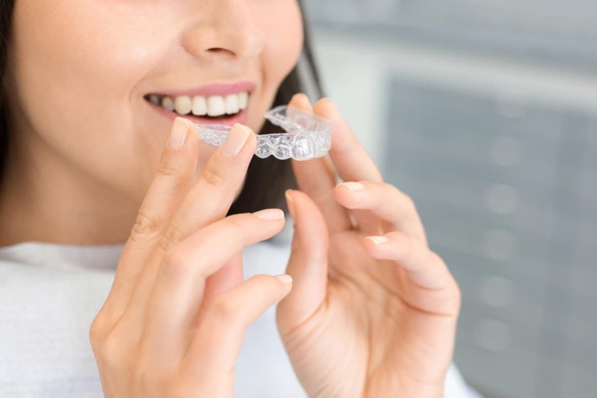 Braces vs. Clear Aligners: What Meriden, CT Patients Should Consider